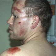 Unfall